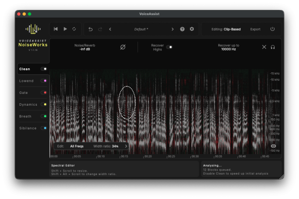 NoiseWorks VoiceAssist Advanced (Download)